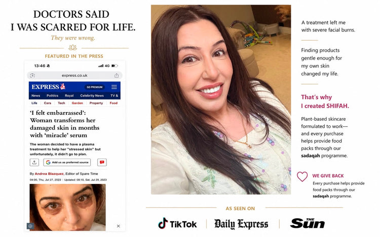 Farnaz Khan’s skin recovery story in the Daily Express